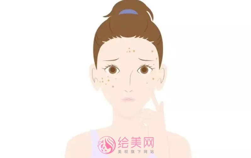 激光祛斑有果吗?祛斑原理是什么?戳进来看真人斑点去除案例吧
