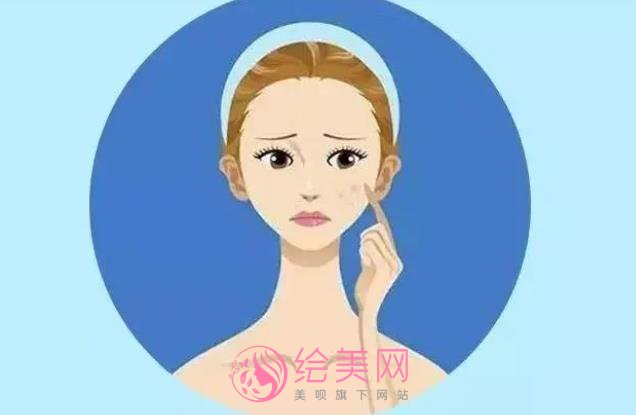激光祛斑有果吗?祛斑原理是什么?戳进来看真人斑点去除案例吧