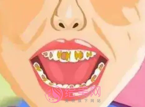 四环素牙如何美白？如何调节呢？术后注意事项有哪些？