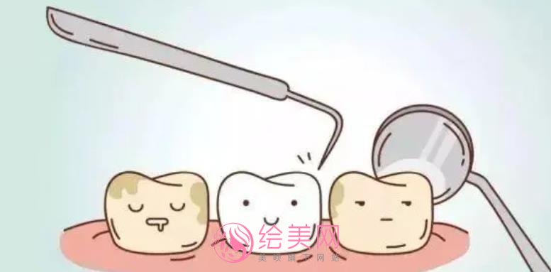 四环素牙如何美白？如何调节呢？术后注意事项有哪些？