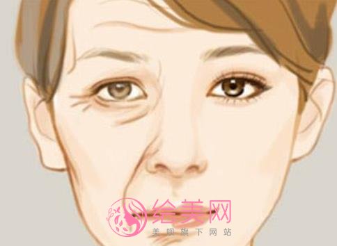 生物术除皱的果好不好?除皱案例对比图分享!