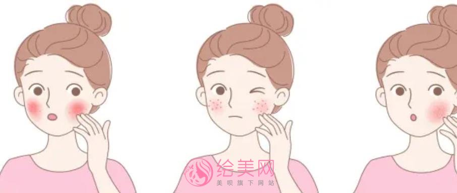 光子嫩肤去红血丝好吗？是什么原理？术后需要注意什么