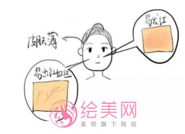 光子嫩肤去红血丝好吗？是什么原理？术后需要注意什么