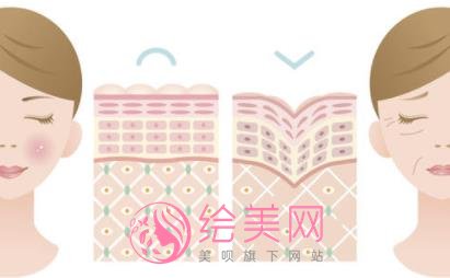 双美胶原蛋白隆鼻价格是多少?注射隆鼻方式原理是什么?