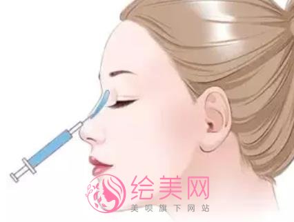 双美胶原蛋白隆鼻价格是多少?注射隆鼻方式原理是什么?