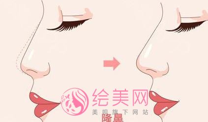 双美胶原蛋白隆鼻价格是多少?注射隆鼻方式原理是什么?