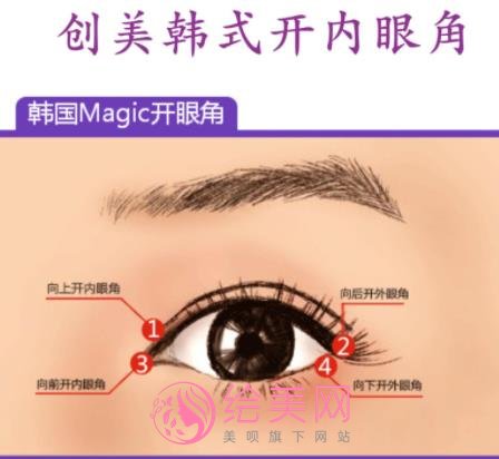 生物焊接双眼皮多少钱？价格影响因素有哪些？做双眼皮有什么需要注意的