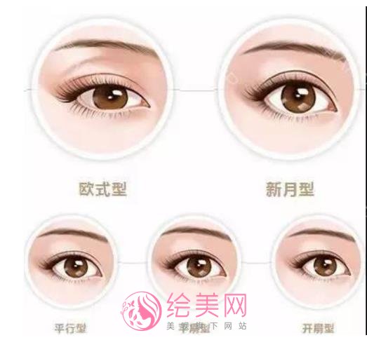 生物焊接双眼皮多少钱？价格影响因素有哪些？做双眼皮有什么需要注意的