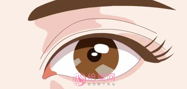 生物焊接双眼皮多少钱？价格影响因素有哪些？做双眼皮有什么需要注意的