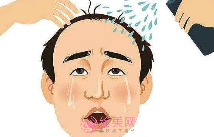 怎么调节脂溢性脱发？调节方式有哪些？注意事项分享！