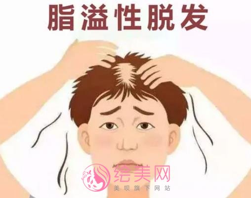 怎么调节脂溢性脱发？调节方式有哪些？注意事项分享！
