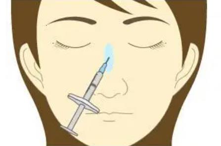 注射隆鼻前后对比图分享！有真人做鼻部整形对比图哦！