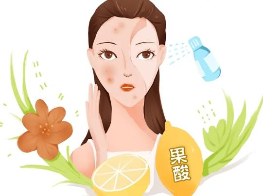 做几次果酸才祛痘印？原理是什么？有哪些需要注意的？