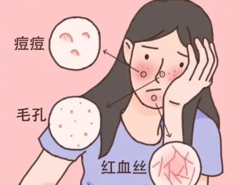 调节脸部红血丝的方法有哪些？激光调节vs光子嫩肤那种果好些？