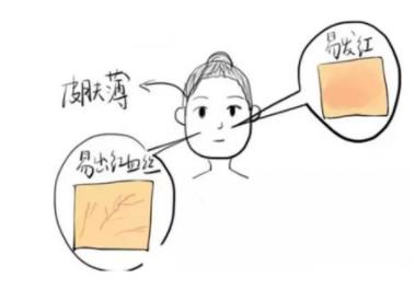 调节脸部红血丝的方法有哪些？激光调节vs光子嫩肤那种果好些？