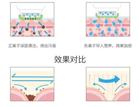 彩光嫩肤吗？果好不好？做完之后要注意哪些事情？