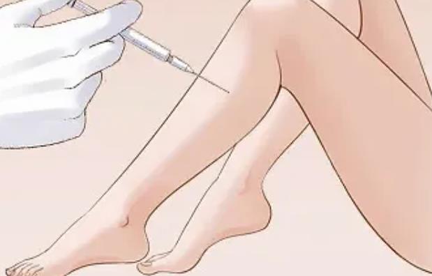 注射瘦腿有吗?需要注意几针?注射前后需要注意哪些事情?