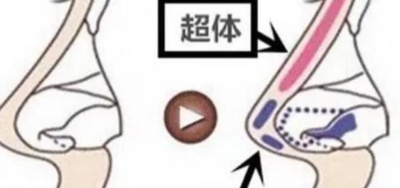 鼻尖整形整容手术特点分析!真人案例及术后恢复期注意事项分享!