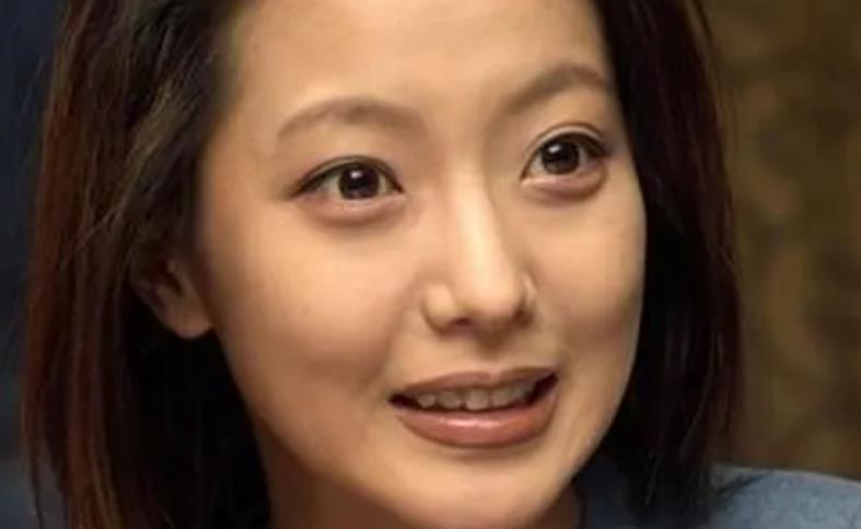 金喜善整容前后差别大吗？做整形之前长什么样子？对比照来袭！