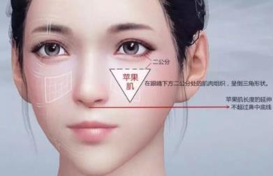 自体脂肪丰苹果肌的果好不好?填充后30天果反馈!