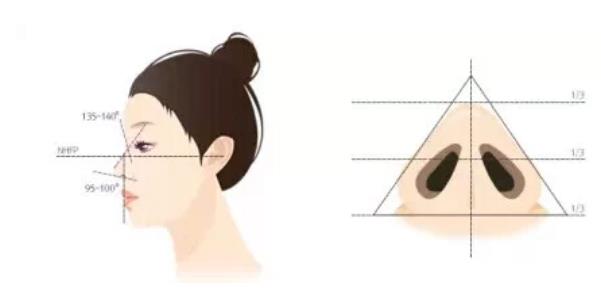 缩鼻翼前后对比照曝光！真人做鼻整形恢复过程图例分享！