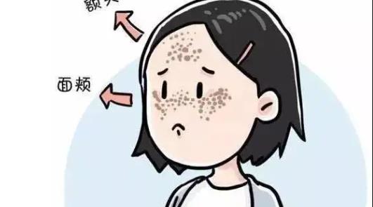 激光祛黄褐斑的危害与果分享！祛斑后果可以维持多久？