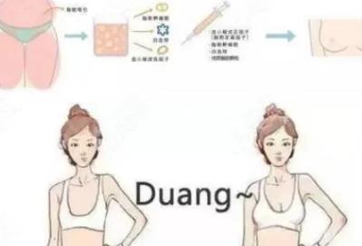 上海脂肪填充真实案例分享!术后逆袭,美到爆!瞬间大妈变美女!