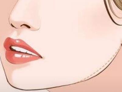 去颊脂对比照片公布!婴儿肥小美女~变身精致大美女!过程分享!