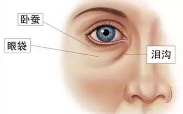 眼袋切除手术能保几年?医疗去眼袋技术有几种?价格多少?