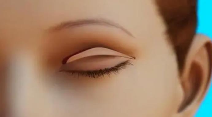 吸雕双眼皮技术可靠吗？真人做眼部整形手术前后对比图曝光！