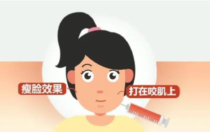 进口多少钱一针?打完之后脸会下垂吗?果能维持多久?