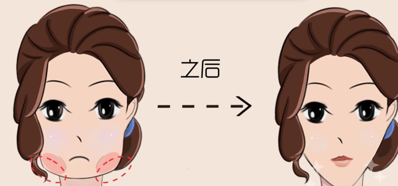 削骨瘦脸手术多少钱?价格的高度和哪些因素有关?手术后多久恢复?