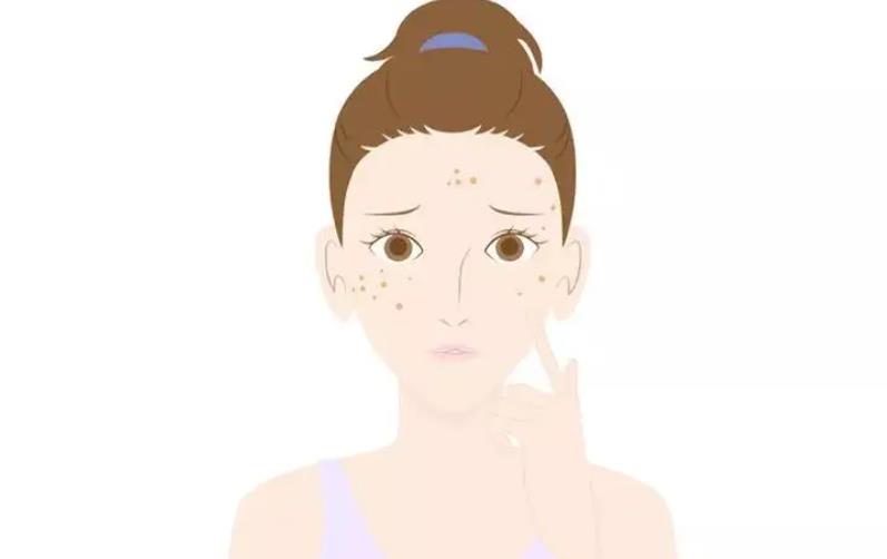 激光祛斑的危害与果有哪些?术后应该如何护理呢?