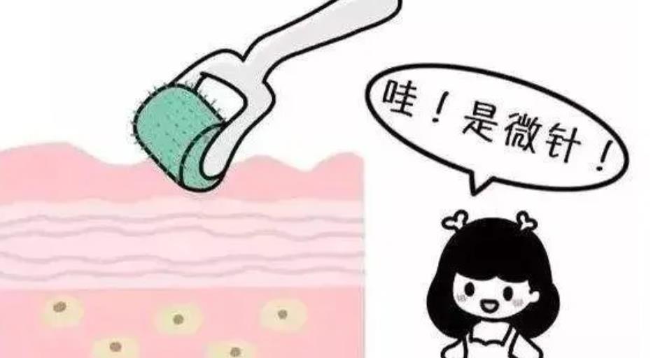 纳米微针经常做对皮肤有影响吗?原理是什么?手术后注意事项分享!