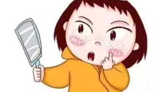 激光祛黄褐斑恢复过程全图曝光!做完祛斑之后恢复期图例分享!