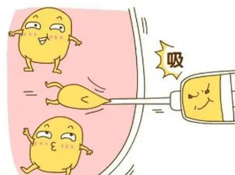 前十天,全脸脂肪填充感觉好丑!熬过了恢复期才是真正果哦!