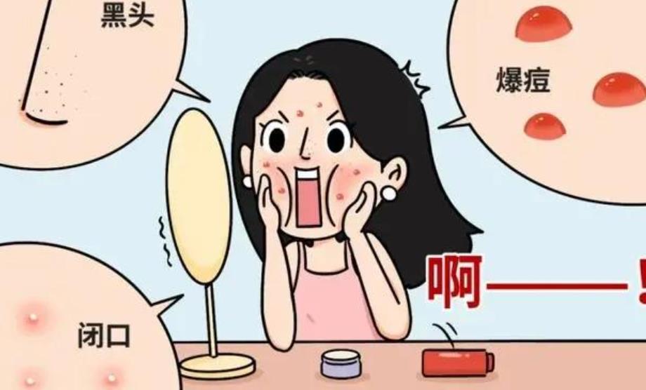 激光调节痤疮会复发吗?如何预防痘痘复发?方法介绍
