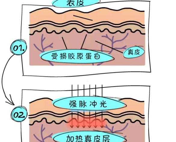 美白嫩肤
