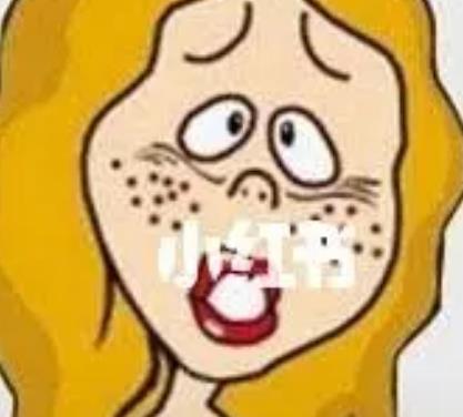 广州激光祛斑案例分享!祛斑不掉坑必看!分享术中术后全过程!