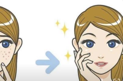 复光祛痘案例介绍!快来看看果好不好?手术真实记录!