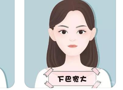 宽下颌角整形案例!真实经历分享!戳进来看看果如何?
