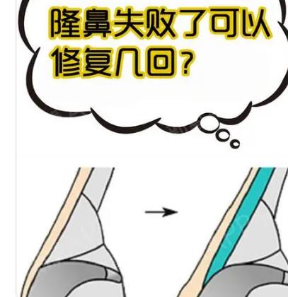 上海隆鼻失败修复手术!修复价格、手术开展攻略!戳进来查看!