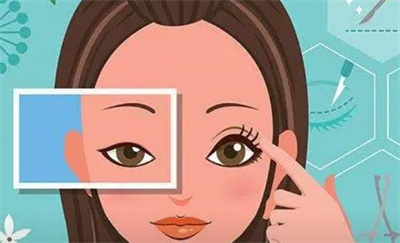双眼皮埋线法案例分享！瞬间改变双眸！大眼睛不是梦，速查看！