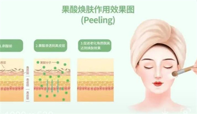 果酸焕肤的果怎么样?真人案例分享!肌肤透亮,有光泽!