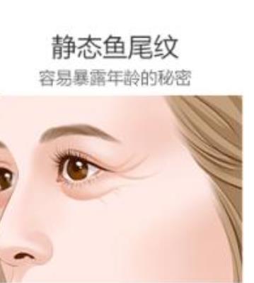 鱼纹多久打一次？如何护理果维持时间的比较长？