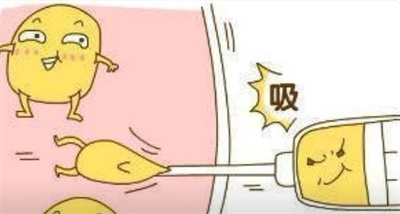 吸脂肪对身体有害吗?什么是吸脂手术?原理、术后注意事项