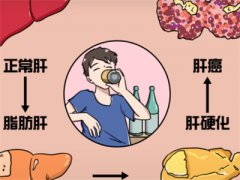 脂肪肝吃什么才能减掉肝脏上的脂肪？如何避免脂肪肝产生？