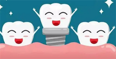 美格尔齿科技术怎么样？是正规的口腔机构吗？医生介绍_案例