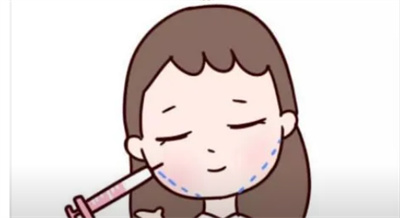 注射瘦脸多久可以看出果?有副作用吗?注射术后注意事项!