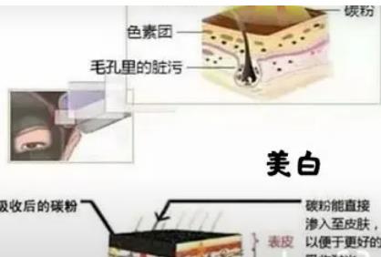 黑脸娃娃做几次好?黑脸娃娃的作用?有缺点和副作用吗?
